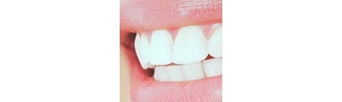 Kits caseros para blanquear los dientes (0.1% HP)